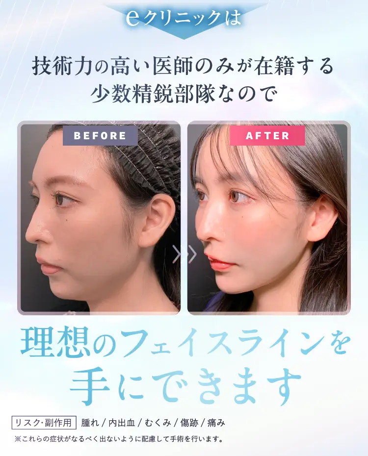 理想のフェイスラインを手に入れます