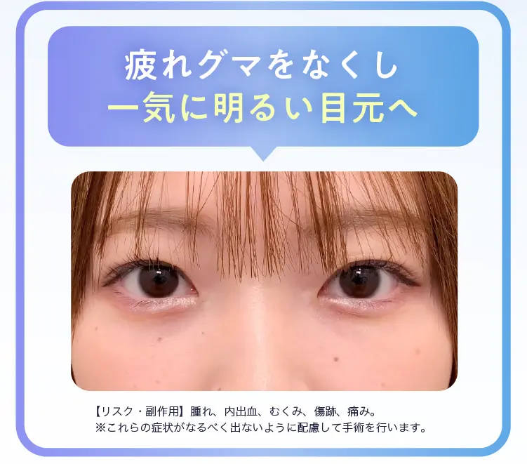 一気に明るい目元へ