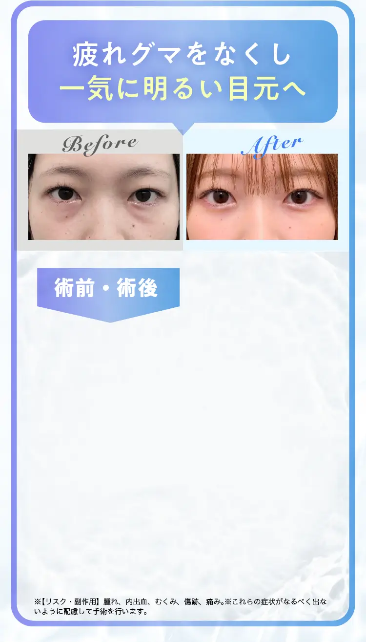 モニター一人目