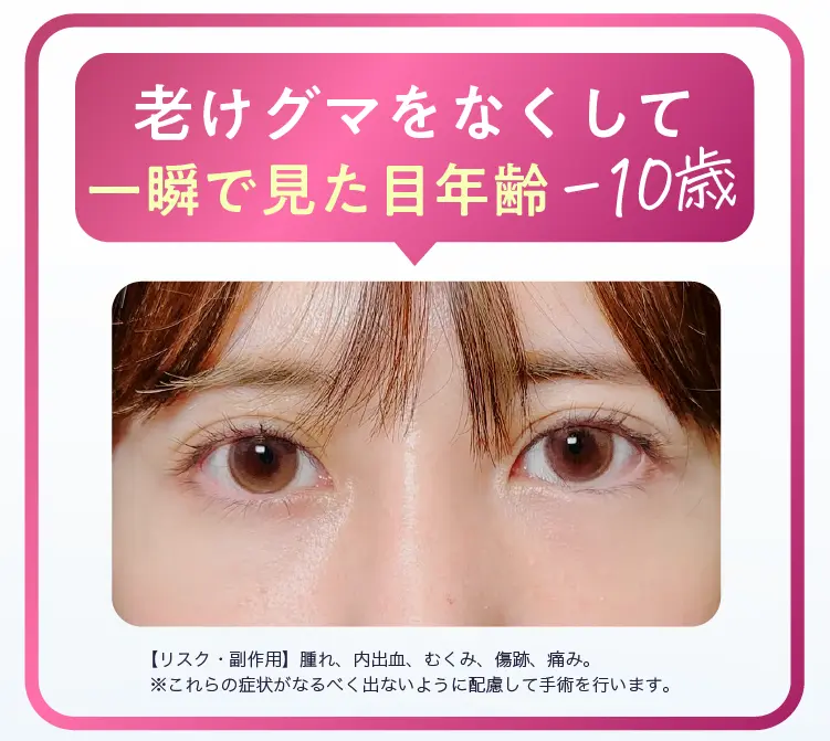 一瞬で見た目年齢-10歳