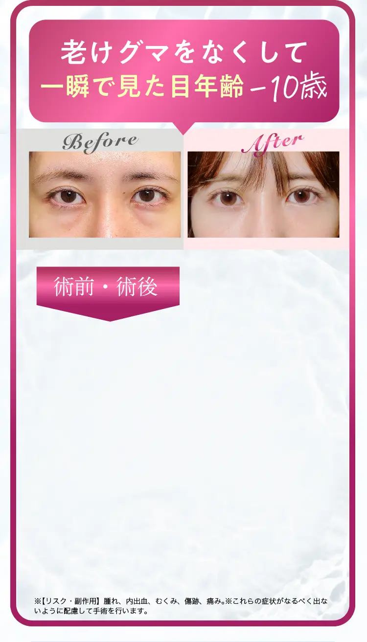 モニター二人目