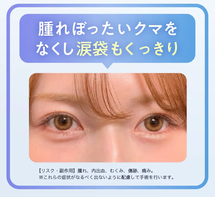 涙袋もくっきり