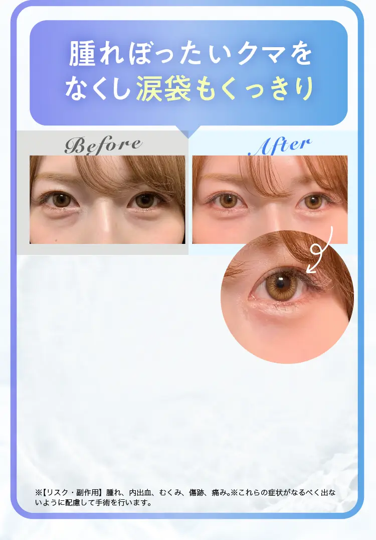 モニター三人目の体験談