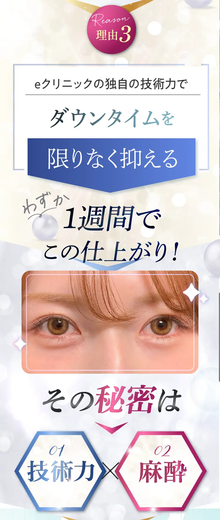 理由3　ダウンタイムを限りなく抑える