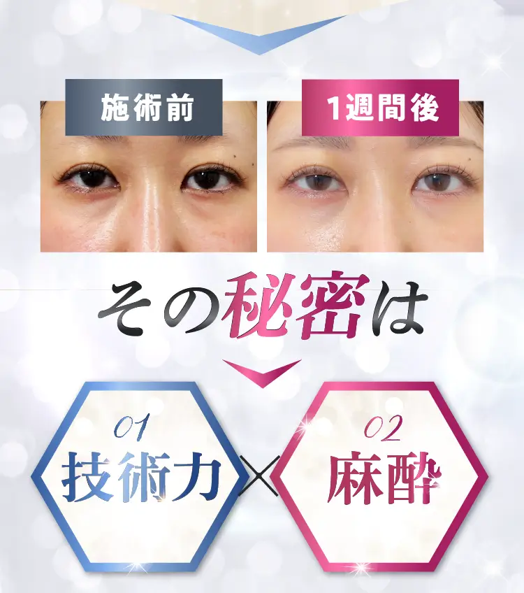 その秘密は技術力と麻酔